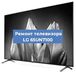 Ремонт телевизора LG 65UN7100 в Новосибирске